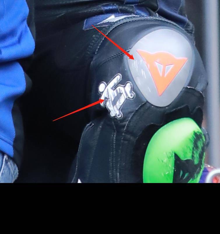 王一博摔车右腿受伤!