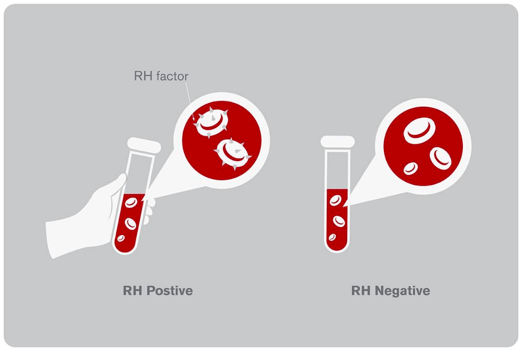 当一个人的红细胞上存在一种d血型物质(抗原)时,则称为rh阳性,用rh( )