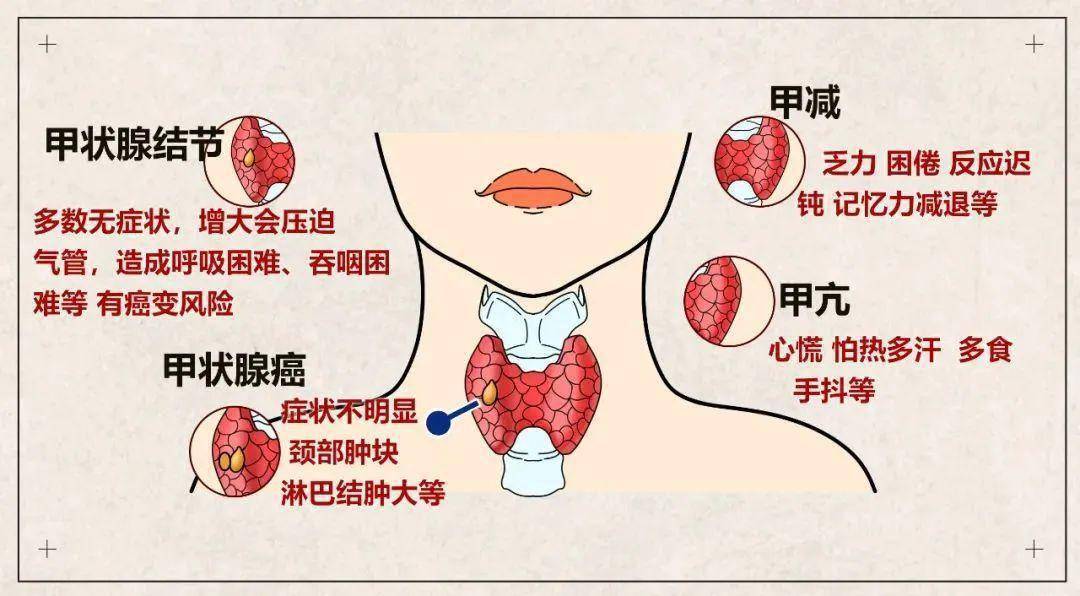 自身免疫甲状腺炎如患者甲状腺功能正常,建议适当限碘,可以食用加碘