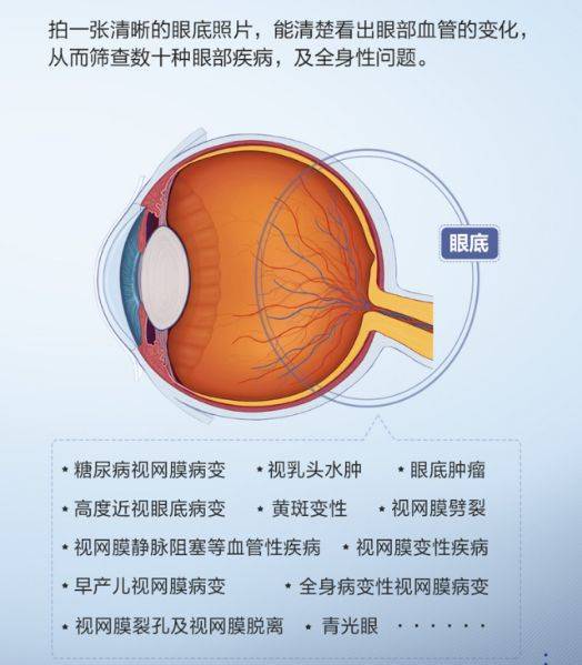 眼病检查报告单图片图片