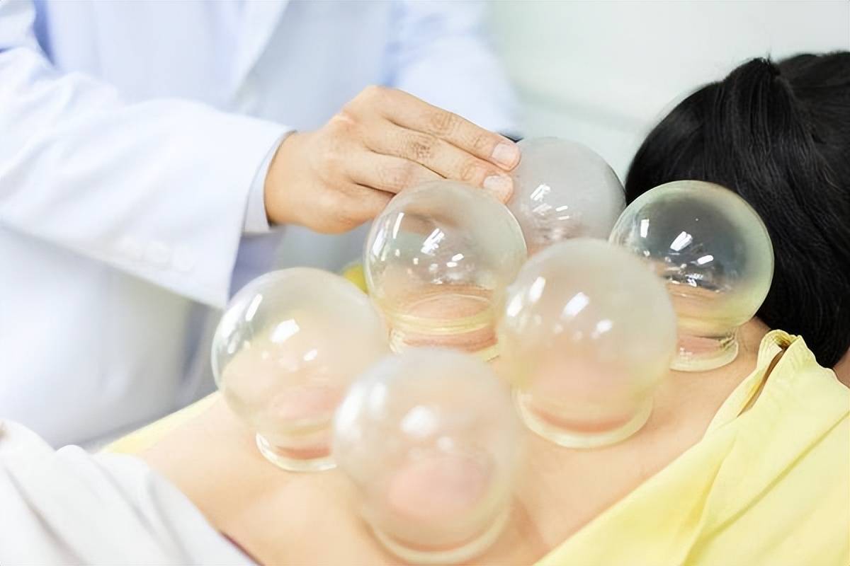 拔火罐的3个真相,拔之前得好好看一看_罐子_时间_关系