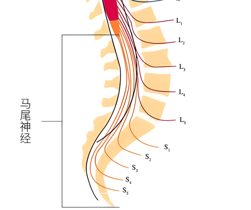 脊髓圆锥马尾终丝图片