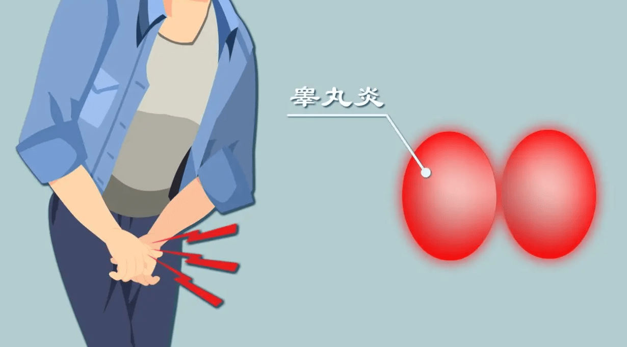 成都男科:浅析睾丸炎症的具体分类_男科医院_时候_九州