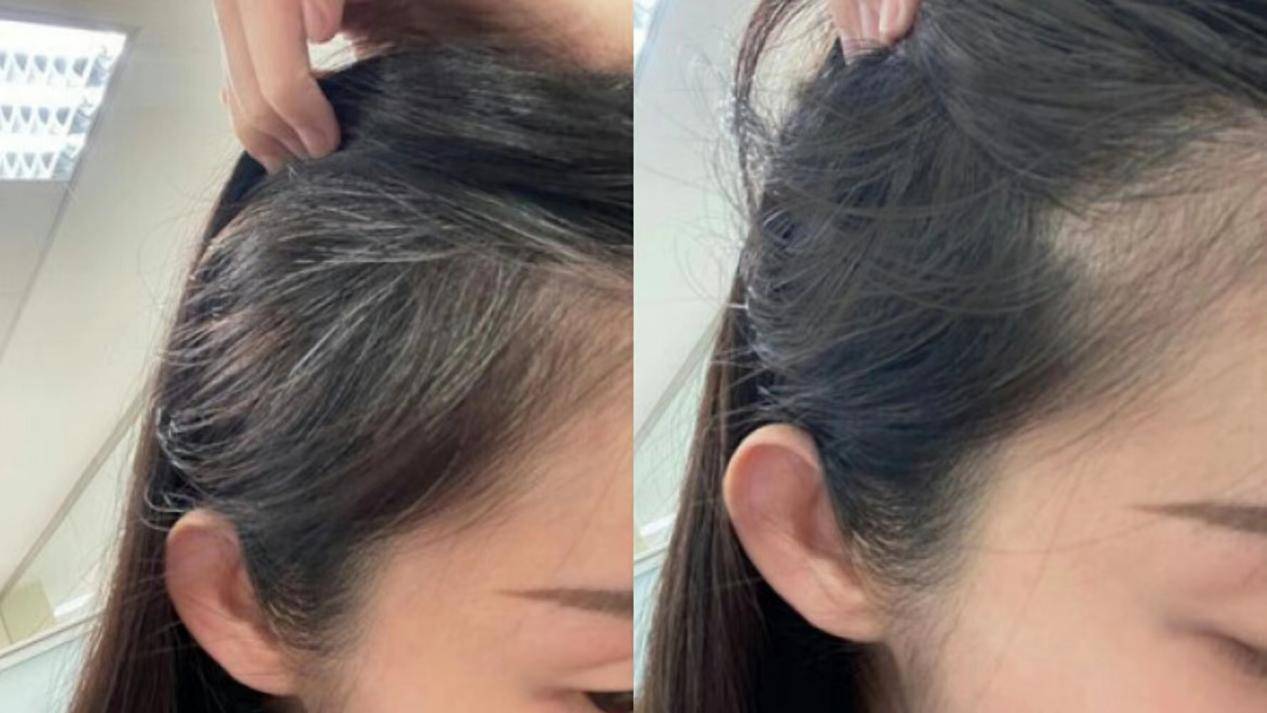 妙手治白发,弘御德隋医师的神奇之处_刘小姐_治疗_问题