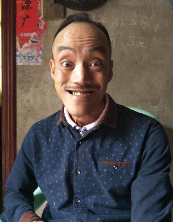 52岁"光头强",走红后娶娇妻,如今卖掉豪车跑摩的,生活艰苦_冯加六