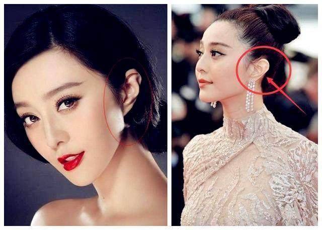 手拨耳垂有口袋状的简单地说,这种耳型的耳垂看起来像贝壳,反扣,而且