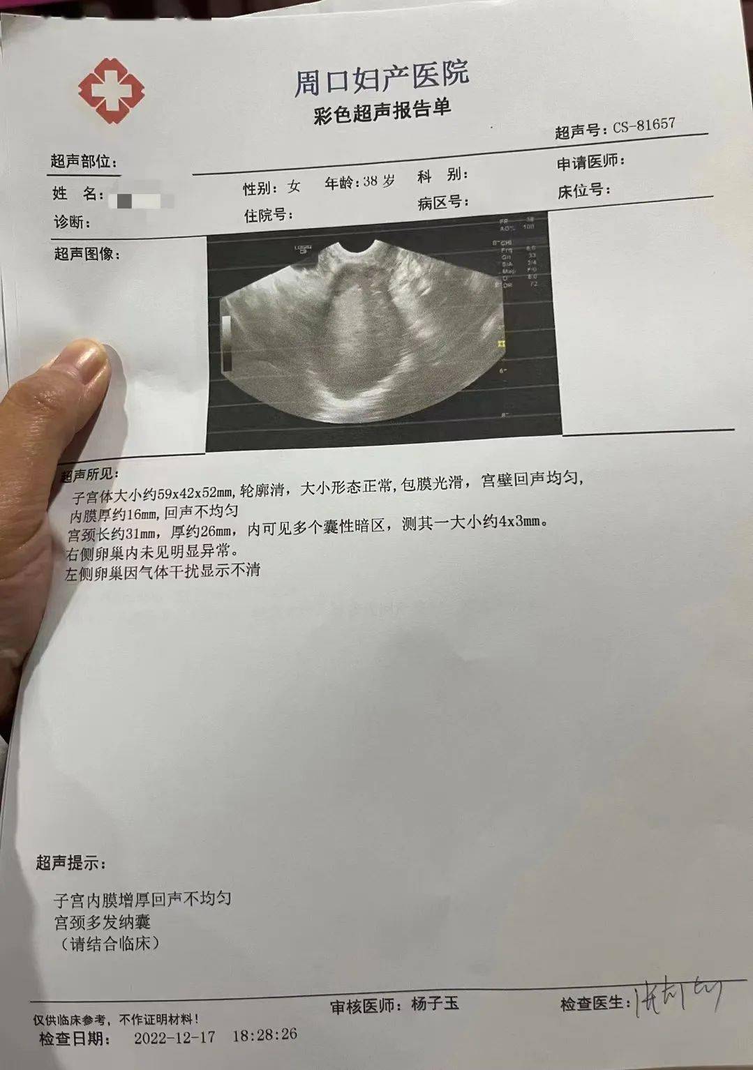 做了彩超检查后发现子宫内膜增厚,约19.3mm