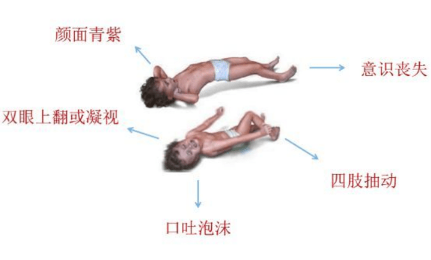 新冠感染小儿高热惊厥误区解读_患儿_山东省_儿童
