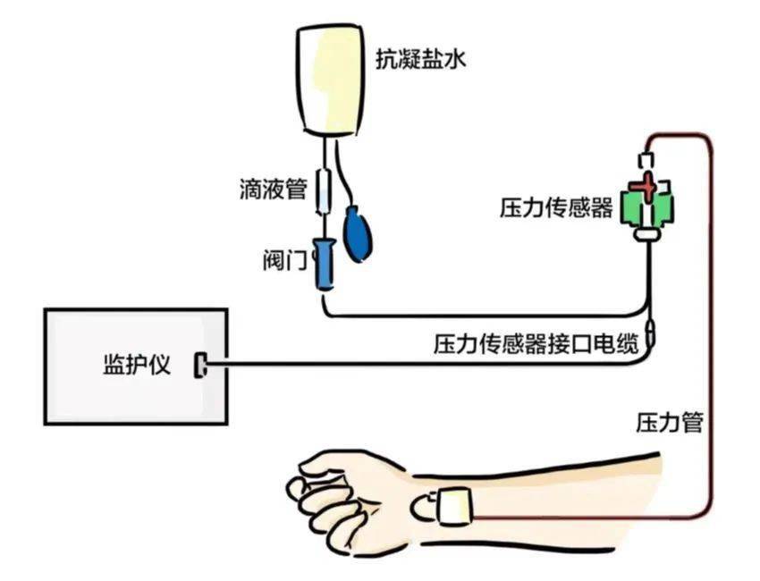 『有创动脉血压监测』是指将动脉导管置入动脉内直接测量动脉内血压的