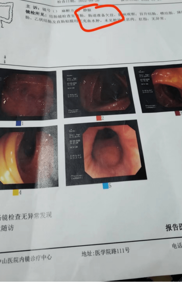 男五女七癌筛体验:上海中山医院无痛胃肠镜全记录_检查_评估_麻醉