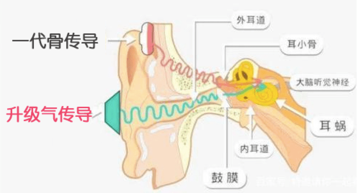 鬼才设想！那个耳钉大小的「骨头耳机」，耳朵都听怀孕了！太绝了