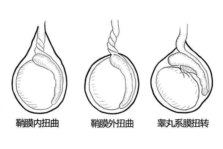 拍打睾丸图片