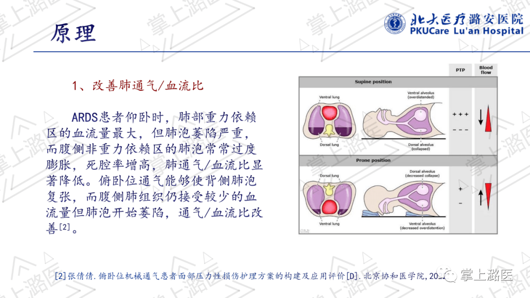 【ppt】俯卧位通气的护理