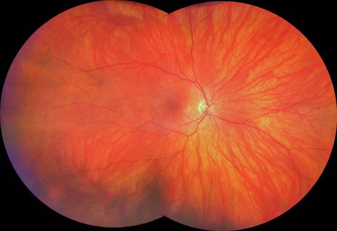 实用篇| 拍摄眼底彩照方法和技巧_患者_相机_图像