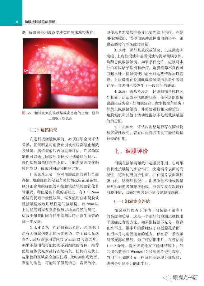 谢培英《角膜接触镜临床手册》原书第4版 中文翻译版