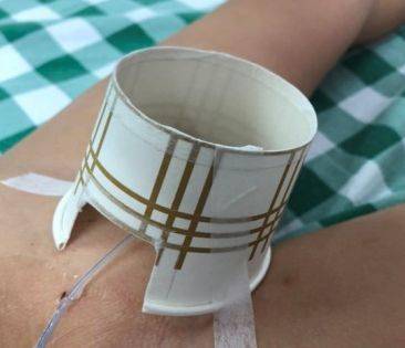 患儿留置尿管有痛难言,护士长居然用纸杯就解决啦?_护理_杯子_胶布