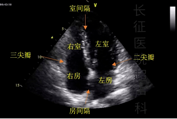 心臟_冠脈_心肌