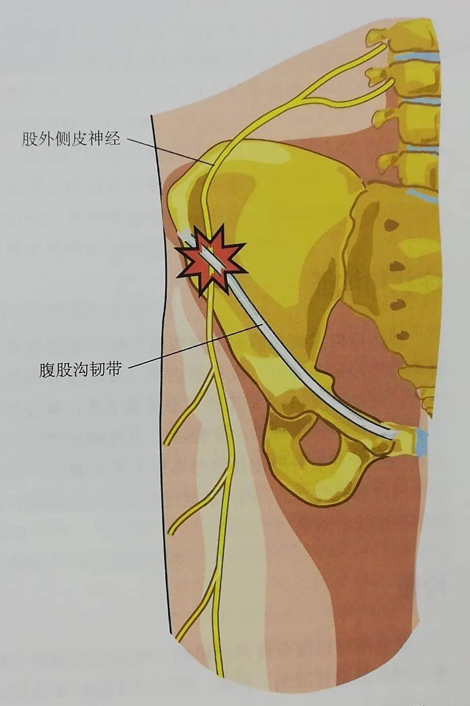 股外侧皮神经损伤