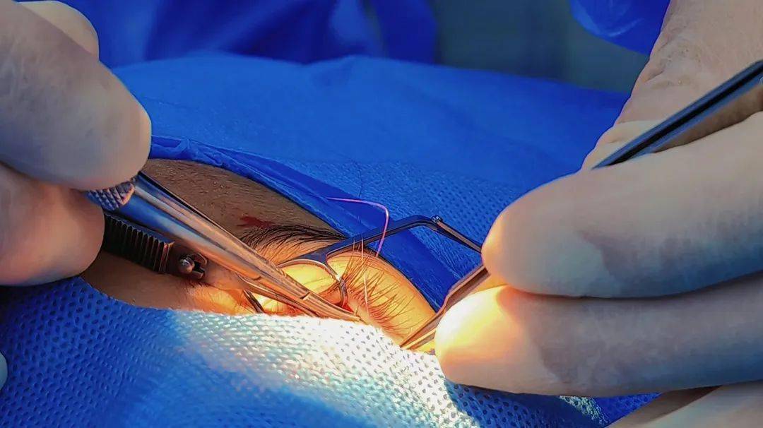 胡敏博士到保山市二院坐诊侧记_患者_问题_防控