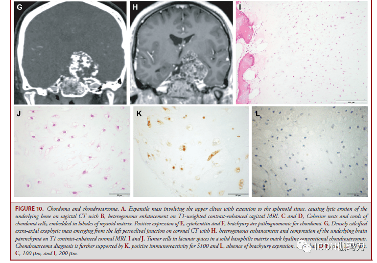 Neurosurgery | ­񾭲ѧٴ