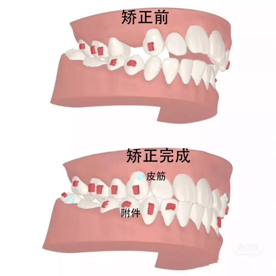 今天起，武汉人将被全国羡慕！刚刚颁布发表，缺牙、牙不齐费用省了……