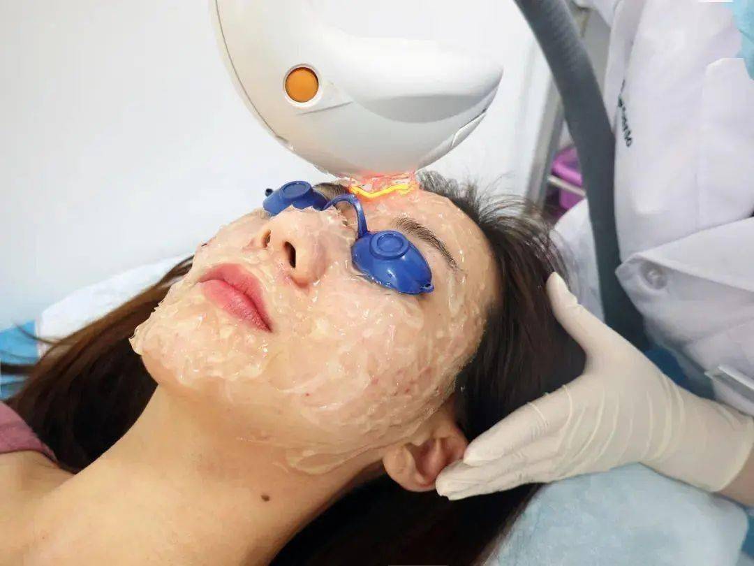 光电综合抗衰开展光子嫩肤,点阵激光,射频等项目可使皮肤紧致,收缩