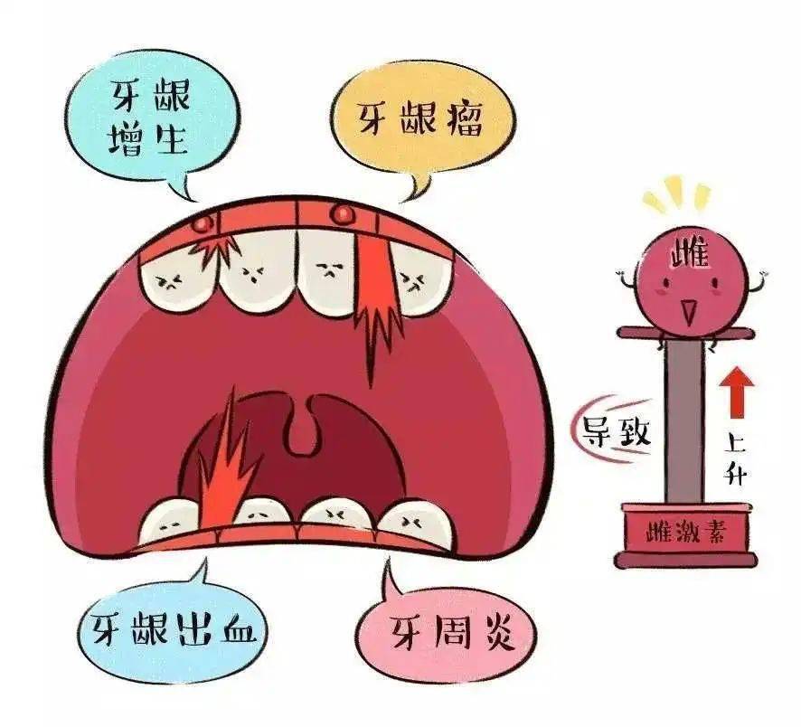 妊娠期龈炎图片图片