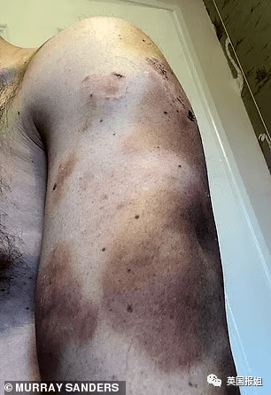 Ӣ˾����Ů�߹ټұ��ɷ�20�꣡ȭ����߾�ƿ�ң��з����� ...