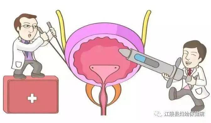 前列腺增生症是老年男性常見病多發病