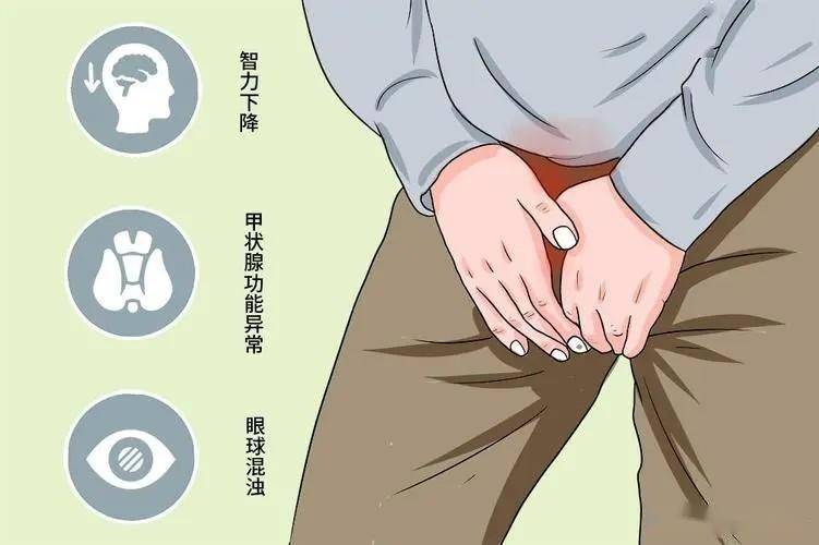 克氏综合征(klinefelter 综合征)