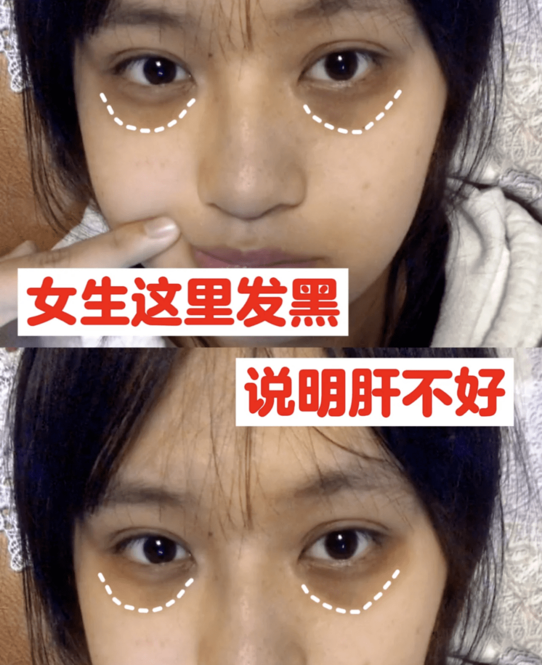 脸长斑,暗沉没气色?肝净=脸净,90岁老中医:你该养肝了_肝脏_身体_效果