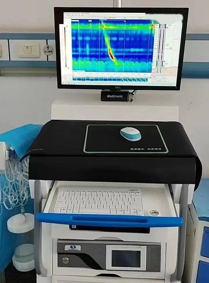 系统我院人民医院院区引进的高分辨率胃肠动力检测系统