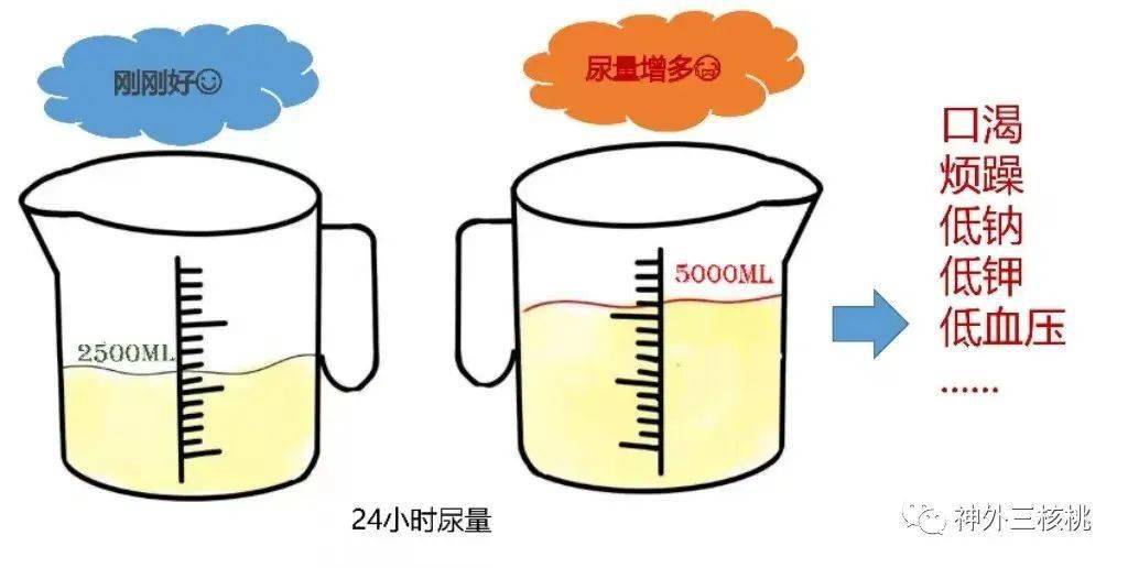 每小时尿量及24小时出入液量:根据医嘱护士会对病