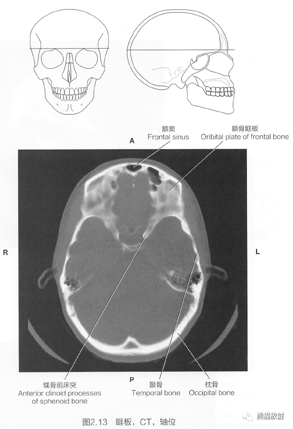 斷解選讀丨腦顱之頂骨,額骨,篩骨~_蝶骨_包括_枕骨