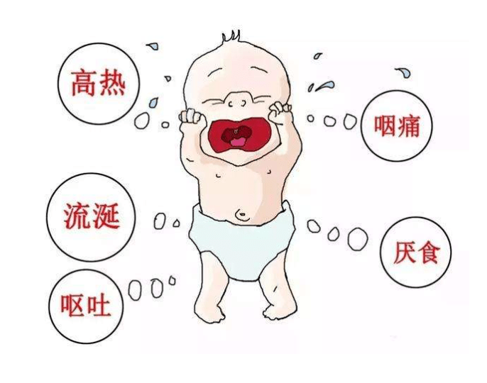 【保健与安全】小儿疱疹性咽峡炎,这些干货请收下!_症状_患儿_家长