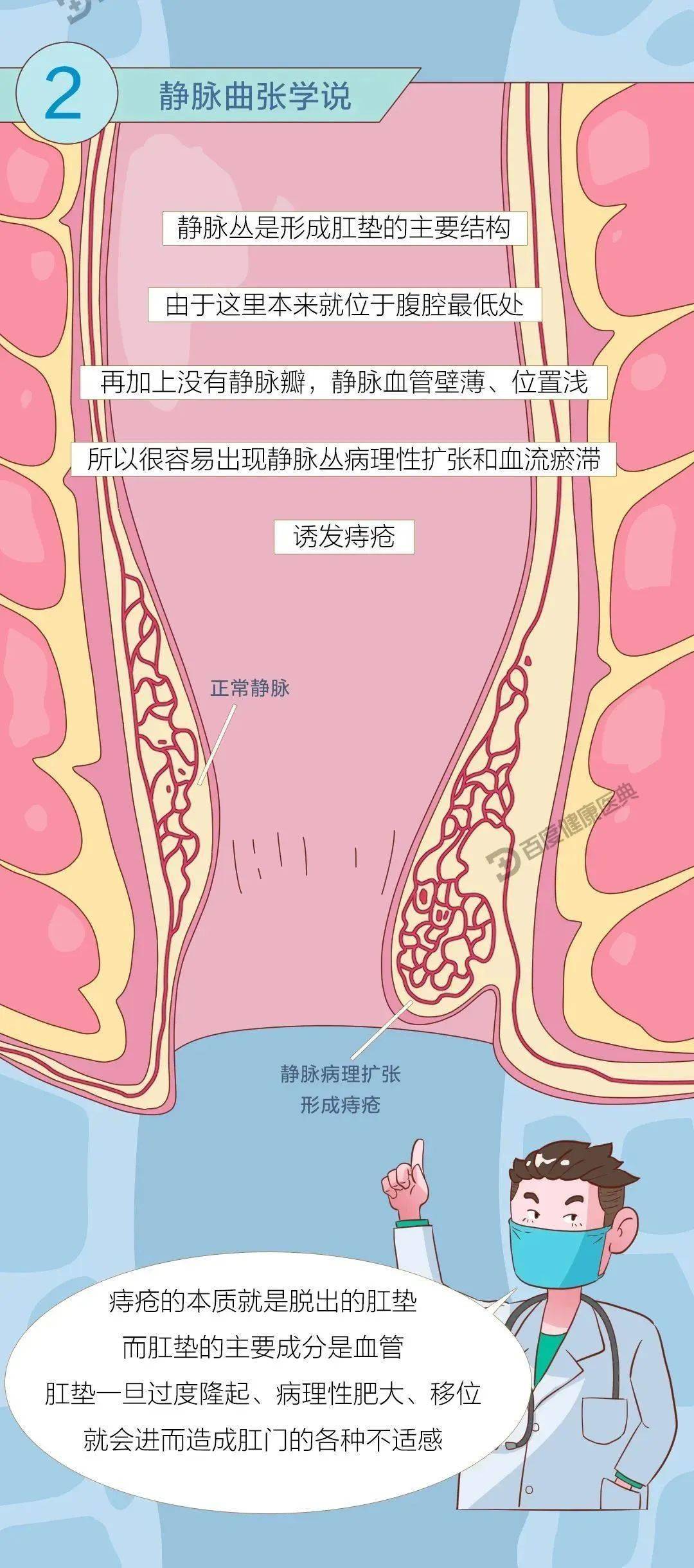 正常的菊花和有痔疮图片