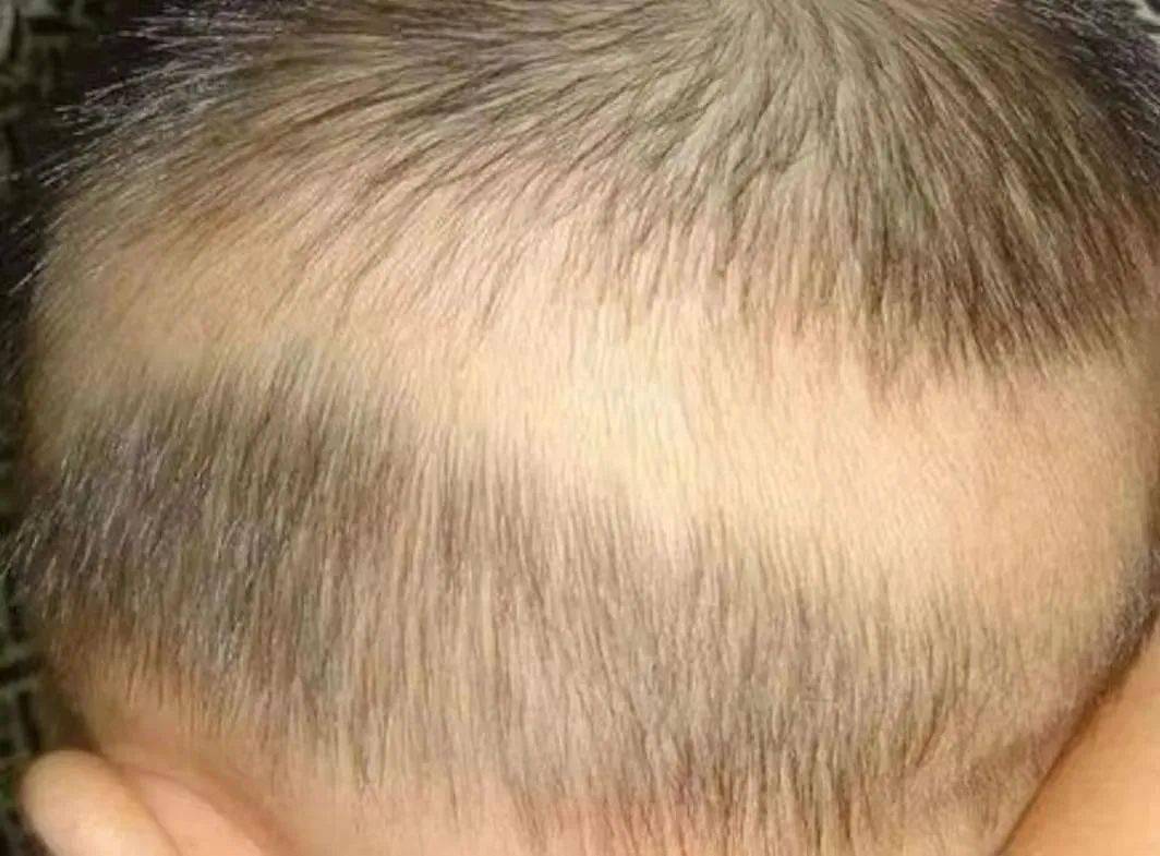 "六一"健康大礼包,送给可爱的军娃们_维生素_孩子_延长时间