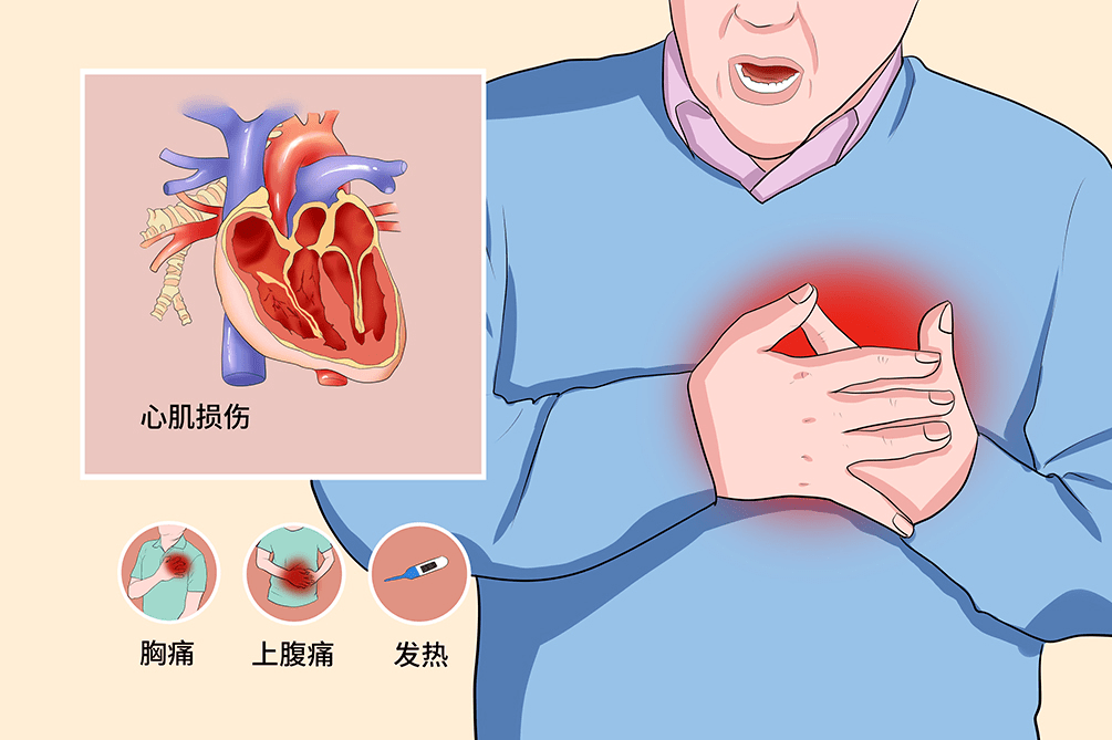 急性冠脉综合征后心源性休克处理麻醉医生必备知识_患者_灌注