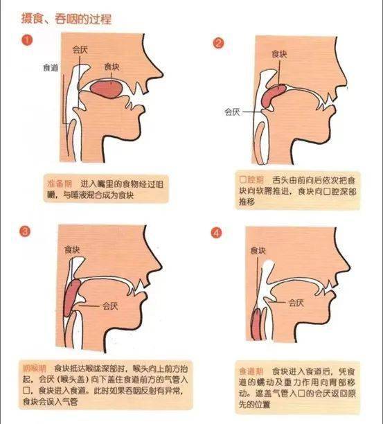 气管食管推移训练图片图片