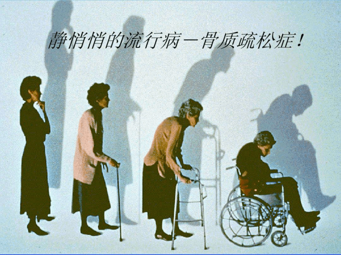 人老了后为什么会越变越矮？原因在这_骨骼_账户_运动