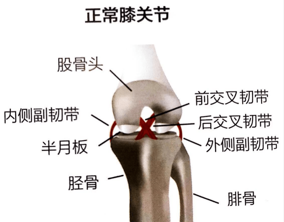 前交叉韧带重建术后如何康复?