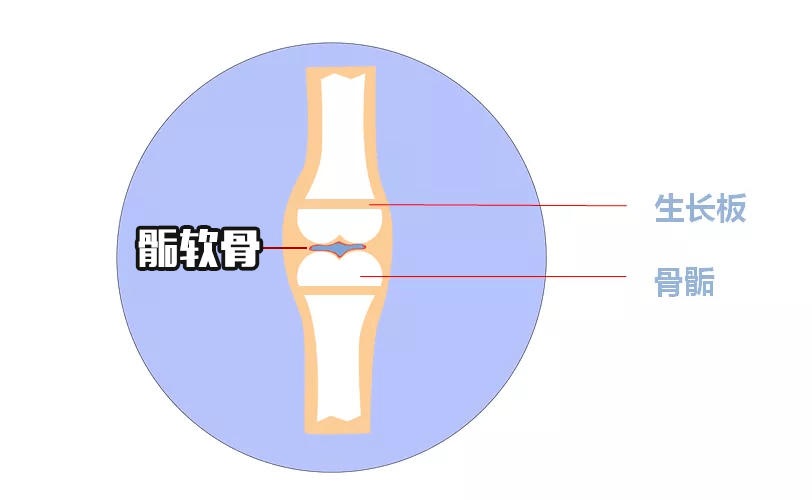 长骨一骺板具体位置图图片