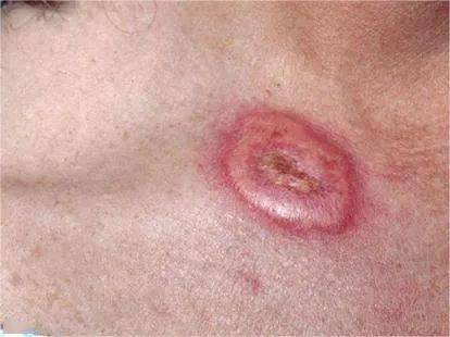 思维导图 | 儿童系统性疾病的皮肤表现_visualdx_breland_网站