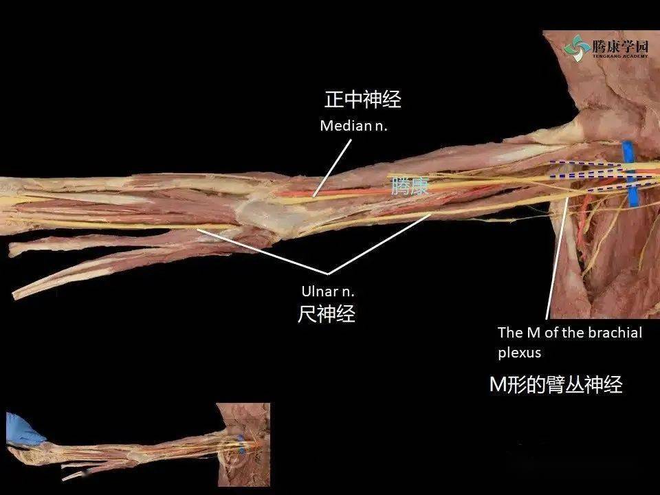 尺神经沟解剖图片