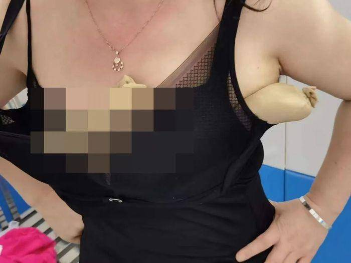 “蛇类”女子胸部藏匿5条活蛇入境！被深圳海关查获