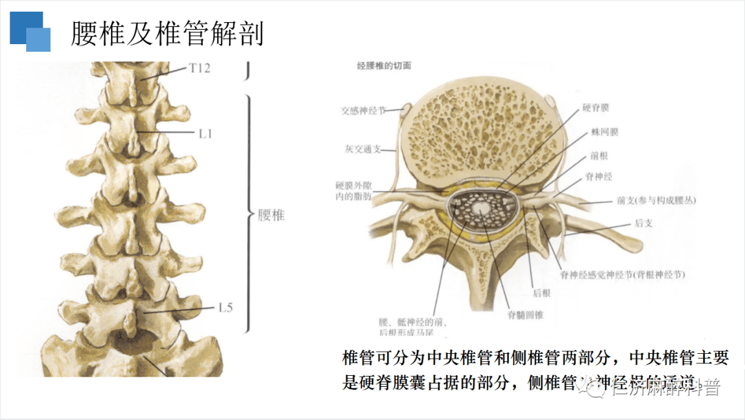 椎旁间隙图片