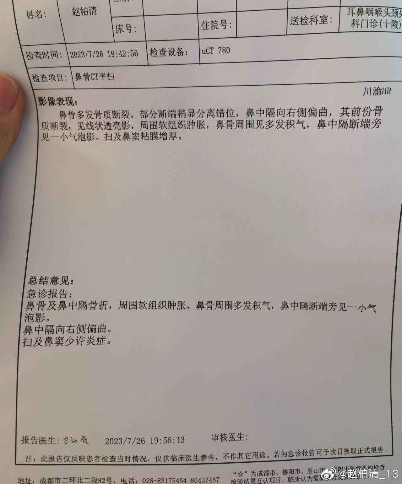 赛前2天热身赛中鼻骨多处骨折,cba南京同曦俱乐部球员赵柏清或缺阵