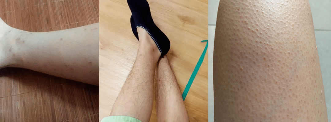 20元买到的丝袜,省下两瓶防晒霜?不但隐形遮瑕,还让你晒不黑!