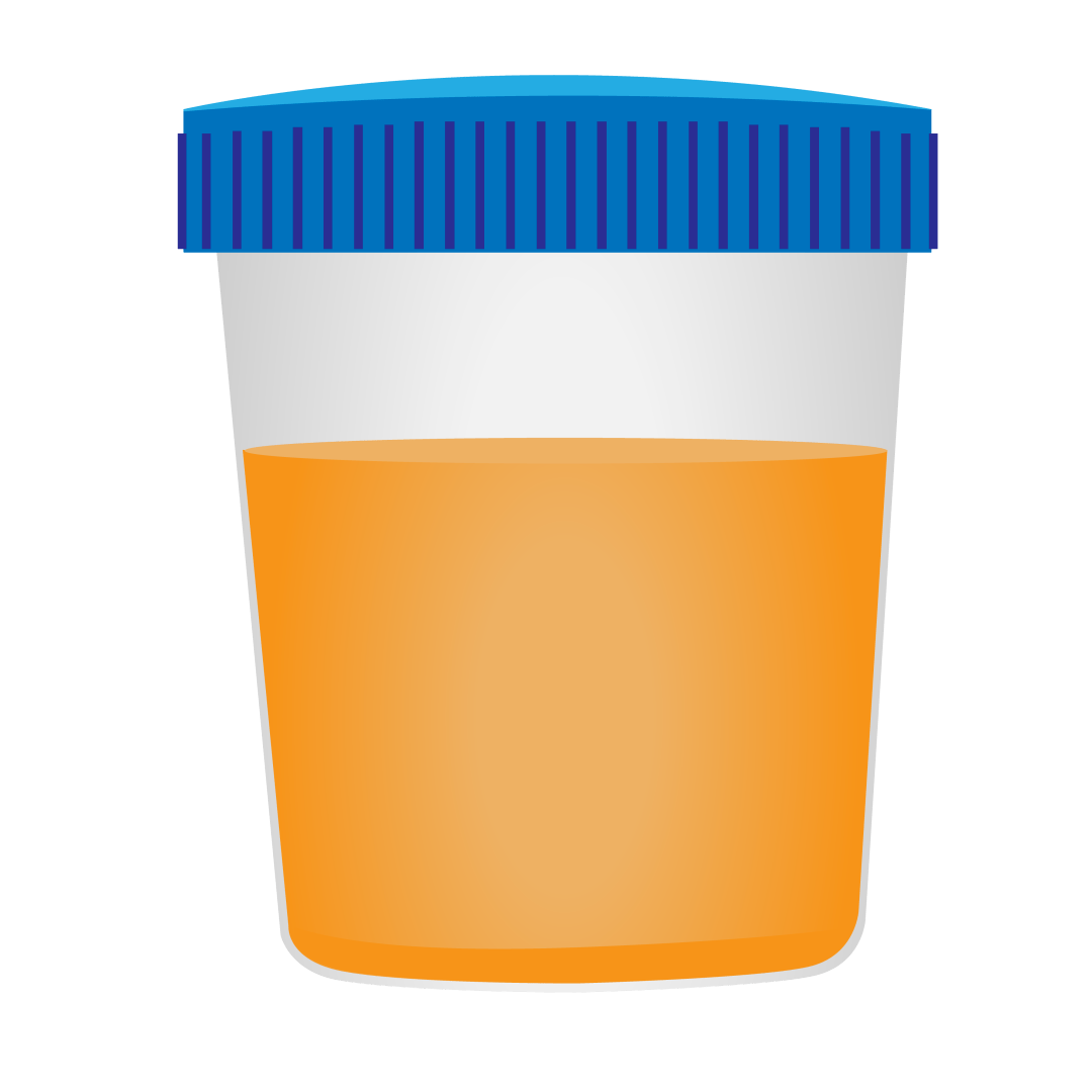 关于尿液的这些小秘密，你知道多少？_气味_尿量_肾脏