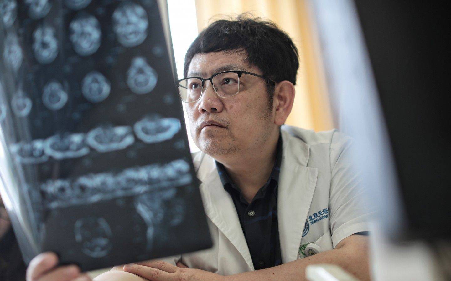 在手指大的脑干区域"舞刀弄枪"_肿瘤_患者_吴震